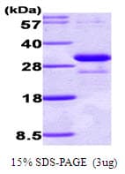 Mouse Adiponectin Protein (Recombinant His)