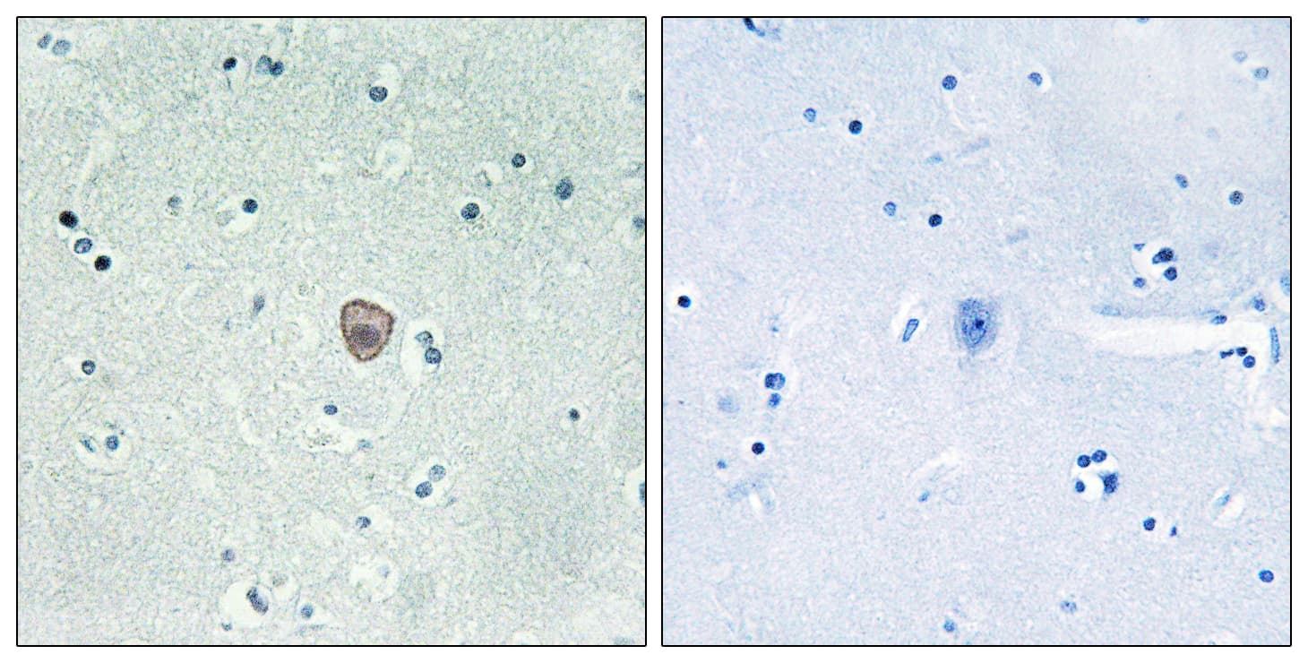 S1PR5 / EDG8 / S1P5 Antibody (aa335-384)