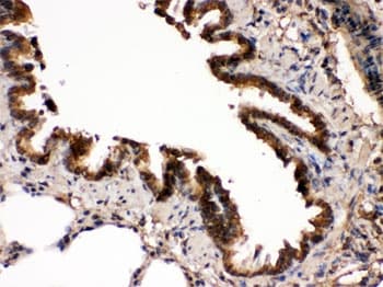 MAP2K7 / MEK7 Antibody