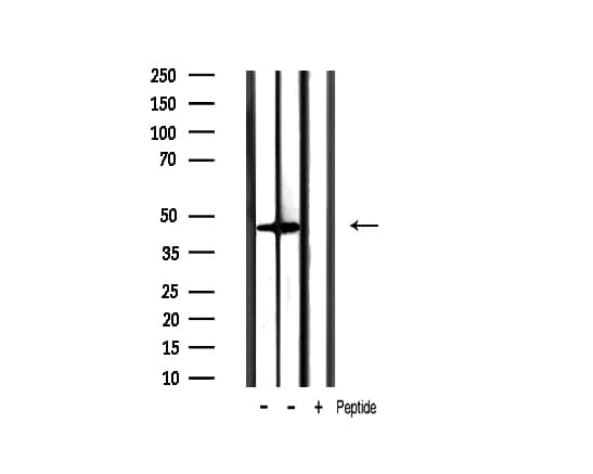 GSK3B / GSK3 Beta Antibody (phospho-Ser9)