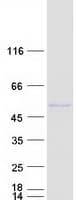 Human SUCLA2 Protein (Recombinant Myc-DDK (Flag))