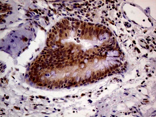 PCMT1 Antibody (aa60-285, clone OTI2A9)