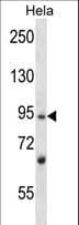 L3MBTL2 Antibody (aa627-656)