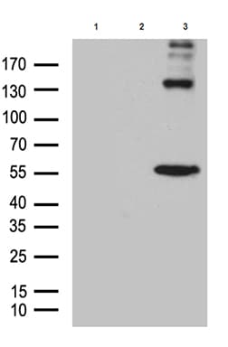 TP63 / p63 Antibody (clone OTI2A7)