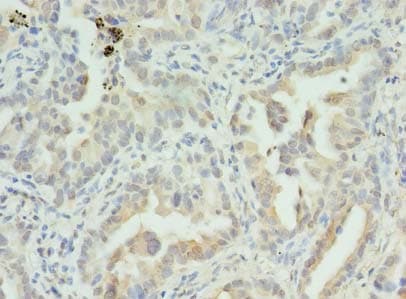 S100PBP Antibody