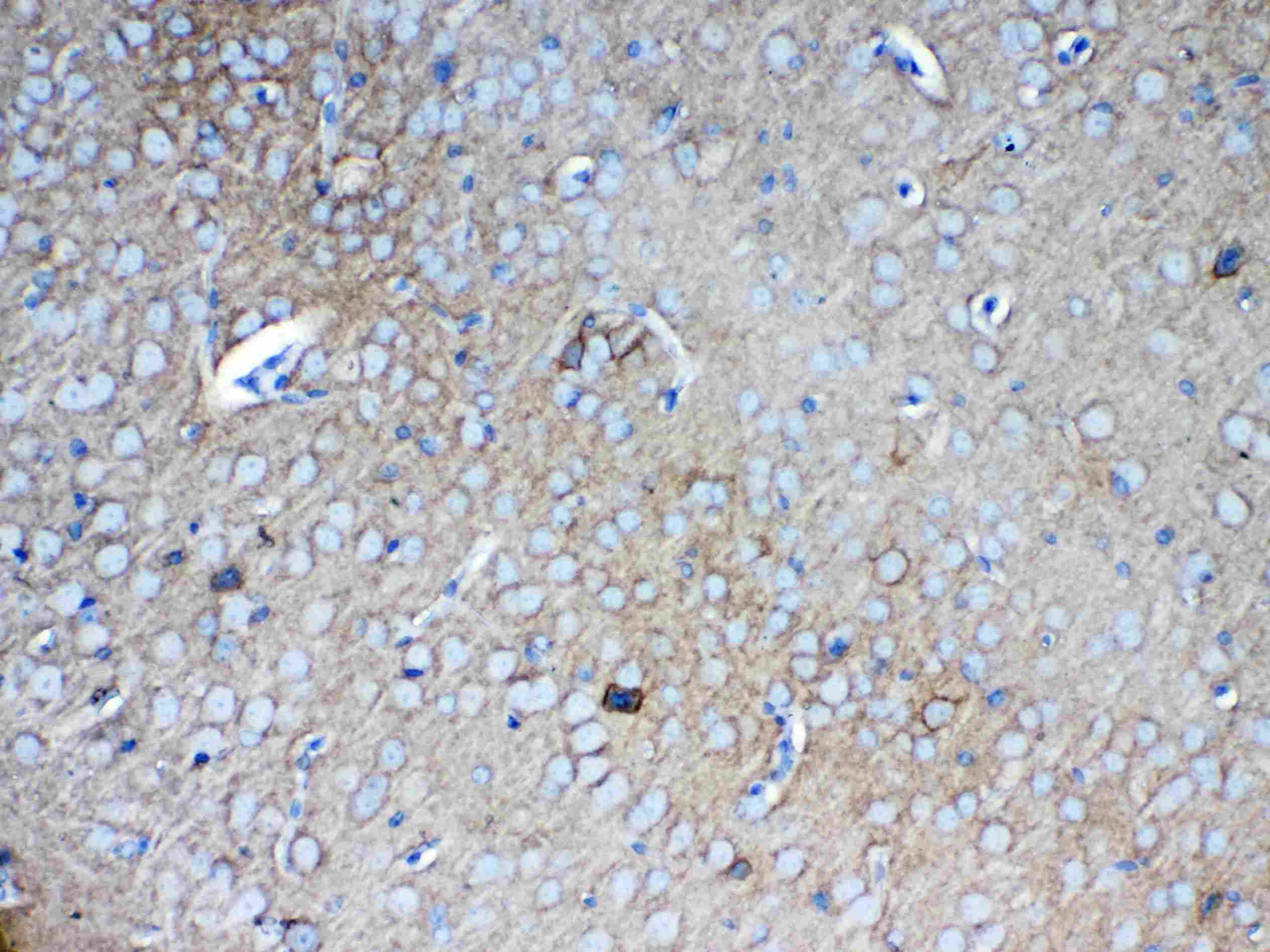 NCAN / Neurocan Antibody