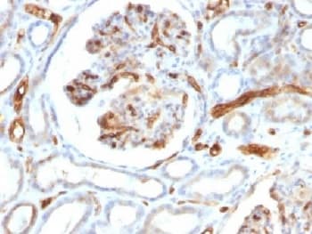 Monoclonal Mouse anti-Human Adipokines / Adiponectin Antibody (clone ADPN/1370, Ready-to-Use, IHC)
