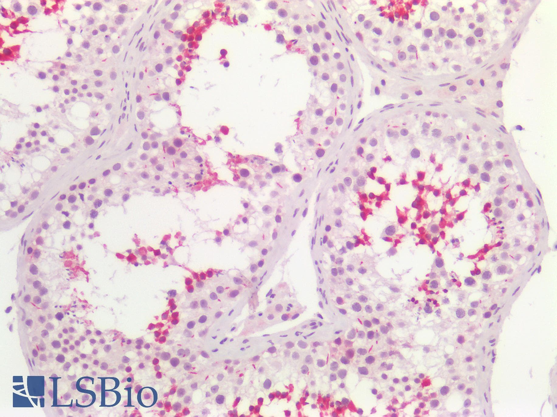 PathPlus™ ACVRL1 Antibody (aa196-245)