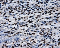 RPA2 / RFA2 / RPA34 Antibody (clone OTI9A1)