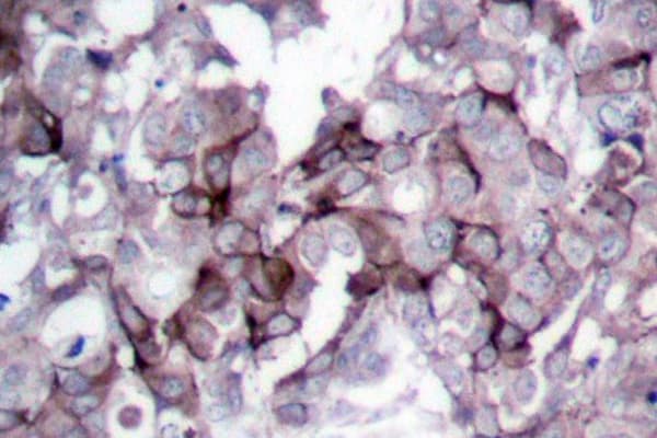 EGFR Antibody (Ser1166)