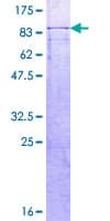Human NIRF / UHRF2 Protein (Recombinant GST)