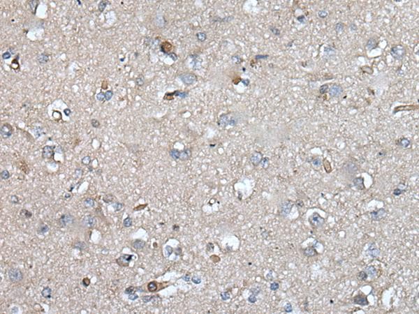 UMPS / OPRT Antibody