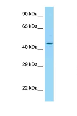 Polyclonal Rabbit anti-Human ADIPOR2 Antibody (C-Terminus, IHC, WB)