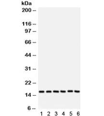 SOD1 / Cu-Zn SOD Antibody