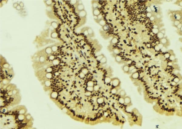 ASF1B Antibody