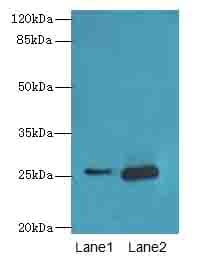 Polyclonal Rabbit anti-Human RAB20 Antibody (IHC, WB)
