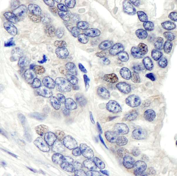 GPS1 / CSN1 Antibody (aa400-C-term)