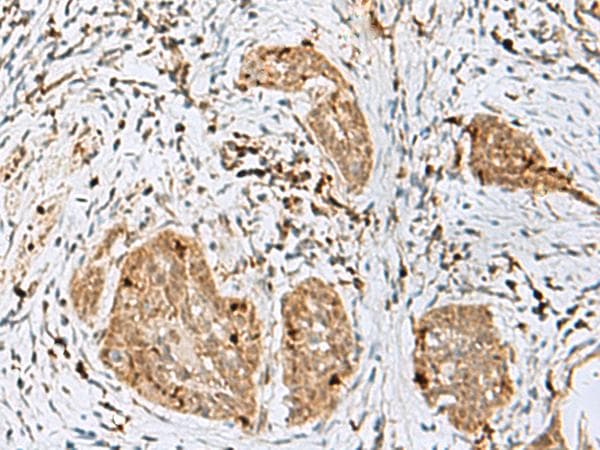 TEX11 Antibody