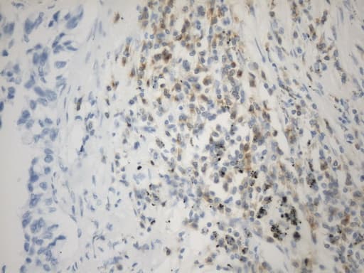 VSIR / GI24 / VISTA Antibody (clone UMAB271)