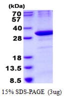 Human OAZ1 / OAZ Protein (Recombinant His)