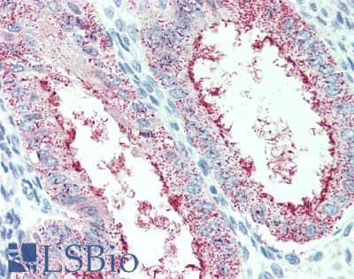 VAC14 / TRX Antibody (aa125-159)