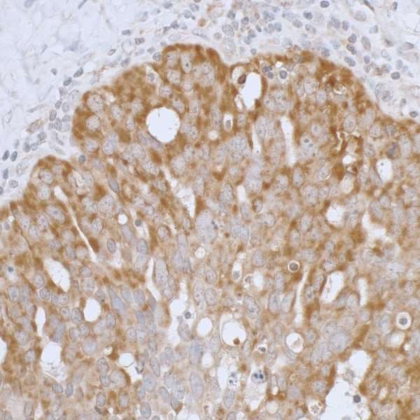 PathPlus™ PRDX3 / Peroxiredoxin 3 Antibody (aa206-256)