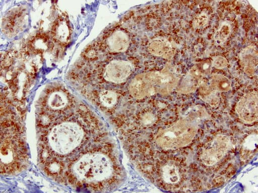 Monoclonal Mouse anti-Human SQSTM1 Antibody (clone UMAB12, Carrier-free, IHC, IF, WB)