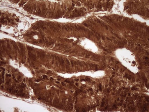 SAE1 Antibody (clone OTI6C7)