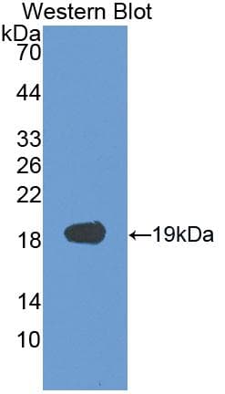 VEGFA / VEGF Antibody (aa28-191)
