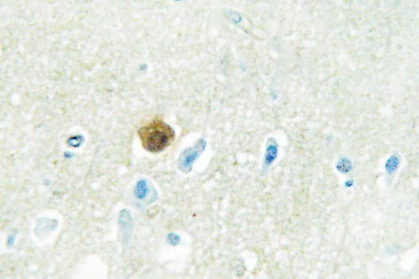 TP53 / p53 Antibody (Leu330)