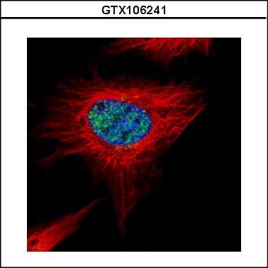 Polyclonal Rabbit anti-Human POLR3A Antibody (aa182-482, WB)