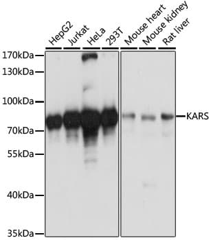 Polyclonal Rabbit anti-Human KARS Antibody (WB)