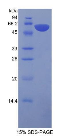 Rat PROS1 / Protein S (Recombinant His-GST)