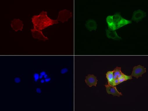 KRT19 / CK19 / Cytokeratin 19 Antibody (aa240-390, clone UMAB186)