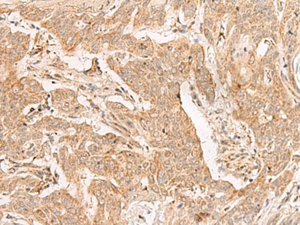 ADGRF1 / GPR110 Antibody