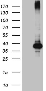 Monoclonal Mouse anti-Human HFE2 / Hemojuvelin Antibody (clone OTI8F4, aa36-263, WB)