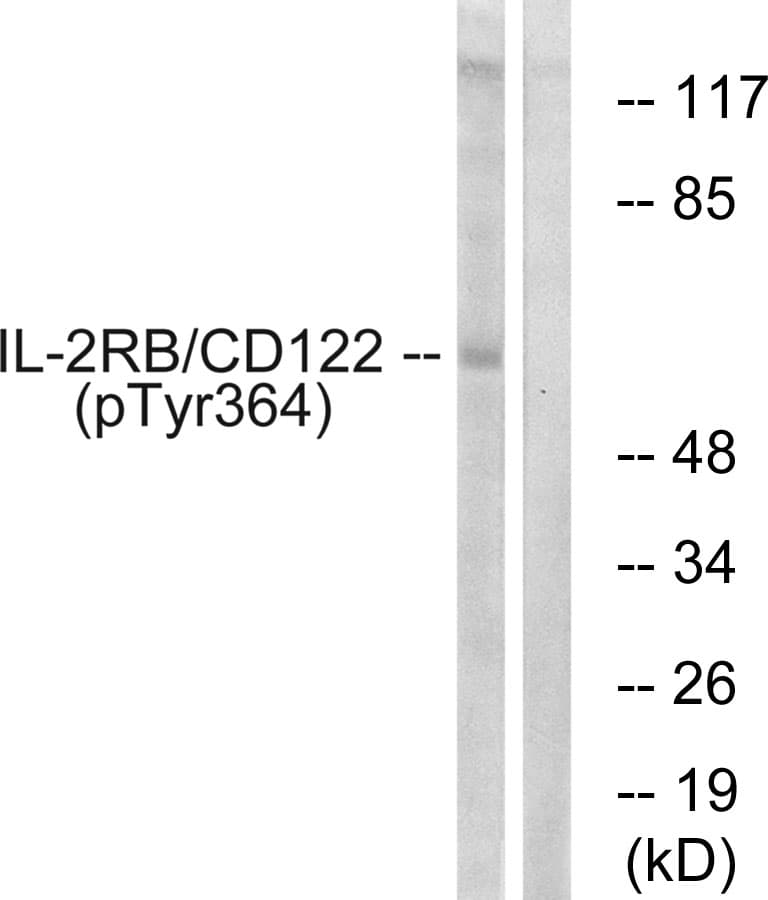 IL2RB / CD122 Antibody (phospho-Tyr364)