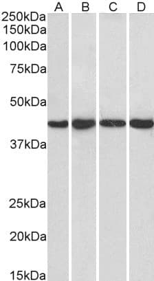 IHC-plus™ Polyclonal Goat anti-Human PPP1R8 / Rnase E Antibody (aa338-351, IHC, WB)