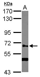 Polyclonal Rabbit anti-Human GALNT14 Antibody (WB)