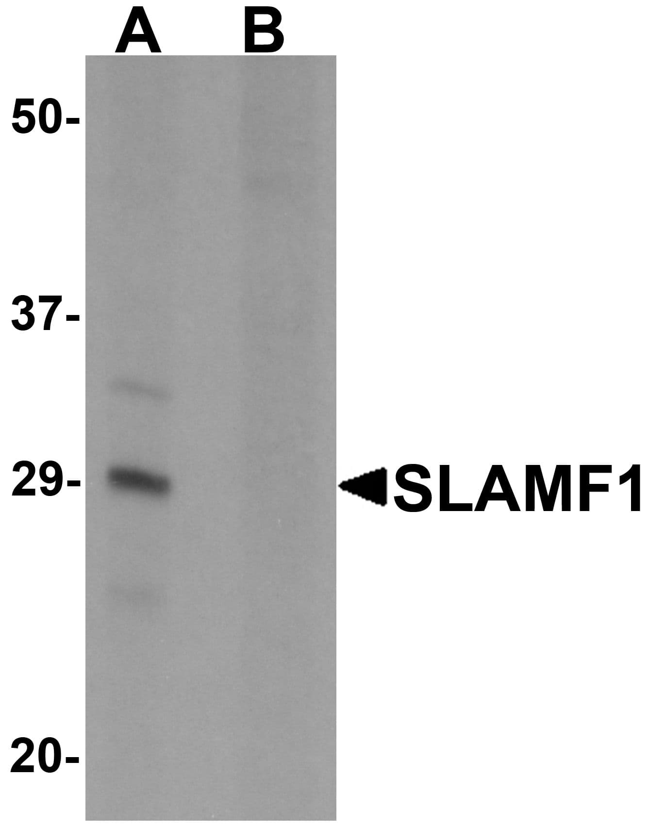 Polyclonal Rabbit anti-Human SLAMF1 / SLAM / CD150 Antibody (IHC, IF, WB)