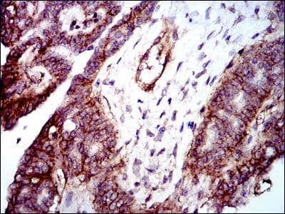 Monoclonal Mouse anti-Human ITGB1 / Integrin Beta 1 / CD29 Antibody (clone 3B6, IHC, WB)