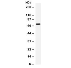 IL12RB1 / CD212 Antibody