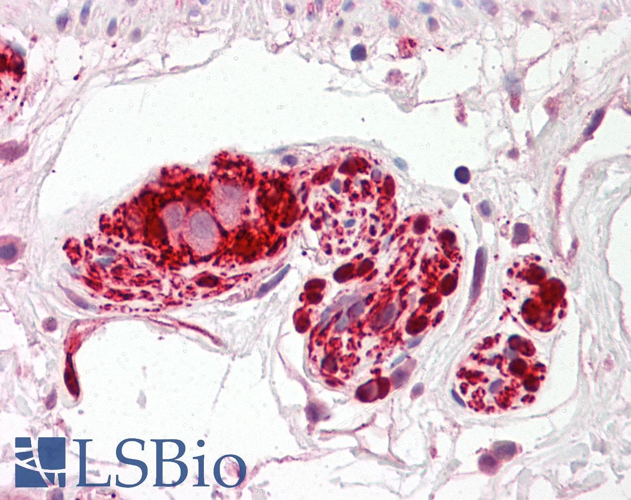 Polyclonal Rabbit anti-Human IFT172 Antibody (aa360-409, IHC, WB)