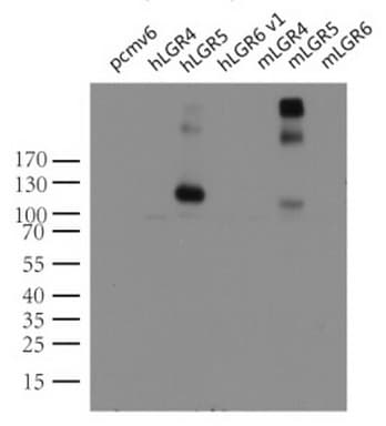 Monoclonal Mouse anti-Human GPR49 / LGR5 Antibody (clone UMAB212, aa22-543, IHC, IF, WB)