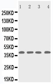 Polyclonal Rabbit anti-Human RRM2B / P53R2 Antibody (aa318-332, WB)