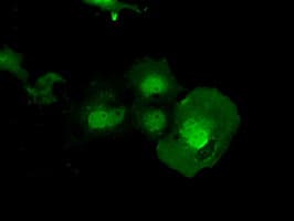 ERCC1 Antibody (clone OTI2H5)