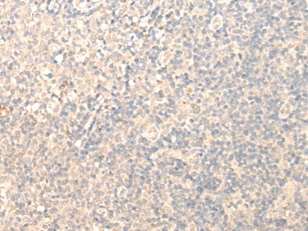 Polyclonal Rabbit anti-Human BM022 / MRPL1 Antibody (IHC, WB)