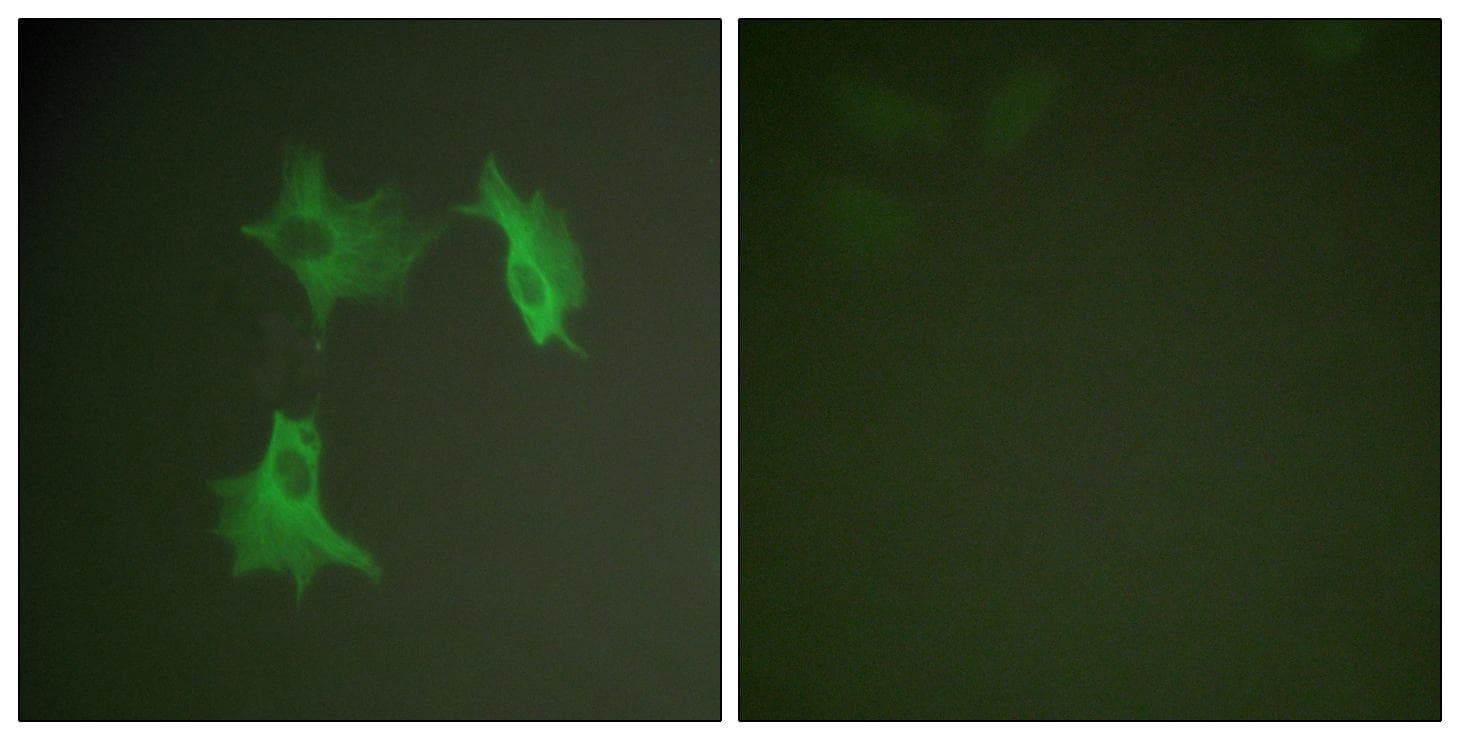 Polyclonal Rabbit anti-Human Alpha Tubulin Antibody (IHC, IF, WB)