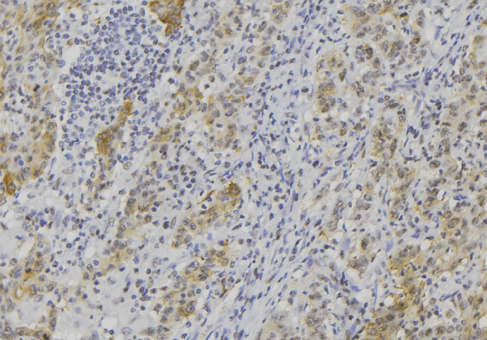 Polyclonal Rabbit anti-Human GZMK / Granzyme K Antibody (IHC, IF, WB)