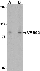 Polyclonal Rabbit anti-Human HCCS1 / VPS53 Antibody (IF, WB)